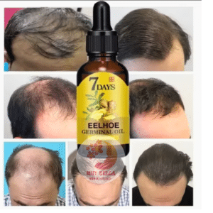 Serum Capilar - Fortalecimiento y Crecimiento